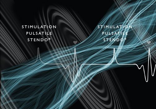 La pulsoterapia Stendo® : la nuova stimolazione che riattiva il sistema circolatorio